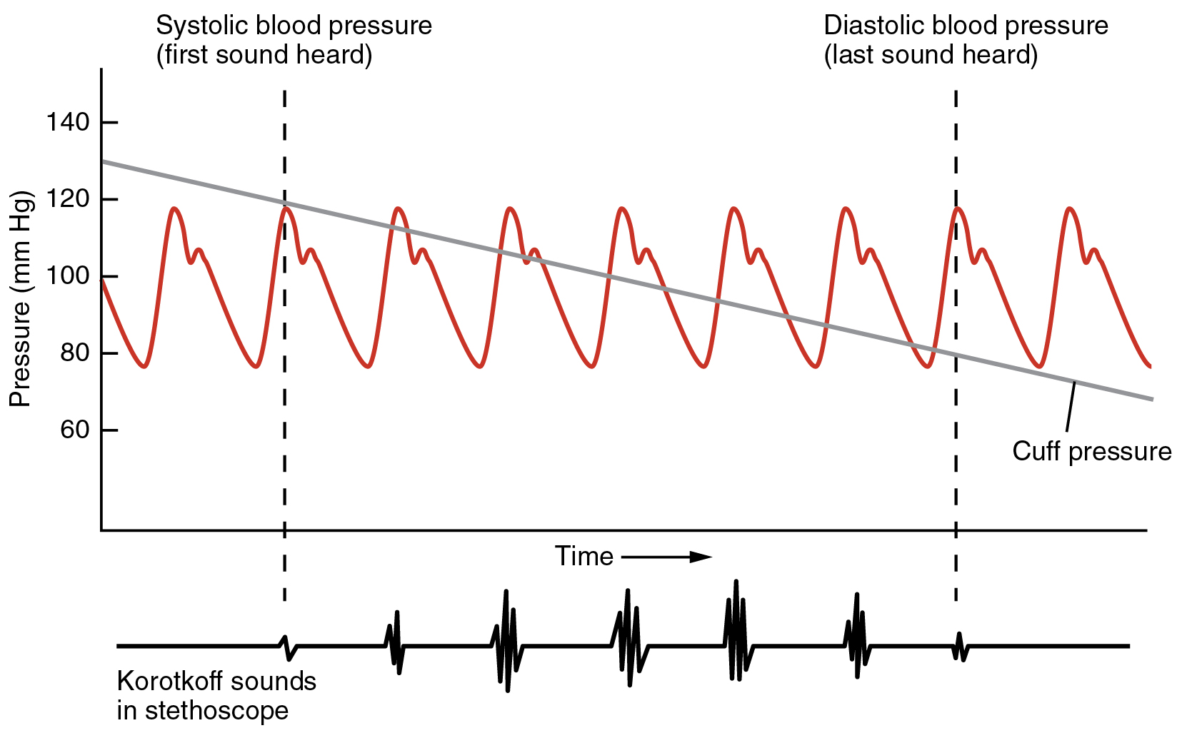 your blood pressure is 125/82. is this too high? | athletic heart